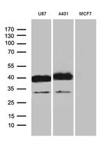 PDPN Antibody in Western Blot (WB)