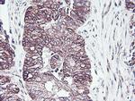 PDRG1 Antibody in Immunohistochemistry (Paraffin) (IHC (P))