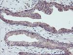 PDRG1 Antibody in Immunohistochemistry (Paraffin) (IHC (P))
