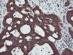 PDRG1 Antibody in Immunohistochemistry (Paraffin) (IHC (P))