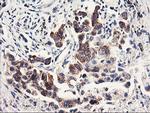 PDSS2 Antibody in Immunohistochemistry (Paraffin) (IHC (P))