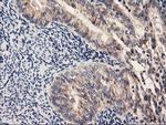 PDSS2 Antibody in Immunohistochemistry (Paraffin) (IHC (P))