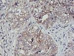 PDSS2 Antibody in Immunohistochemistry (Paraffin) (IHC (P))