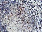 PDSS2 Antibody in Immunohistochemistry (Paraffin) (IHC (P))