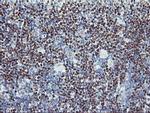 PDSS2 Antibody in Immunohistochemistry (Paraffin) (IHC (P))