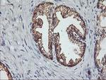 PDSS2 Antibody in Immunohistochemistry (Paraffin) (IHC (P))