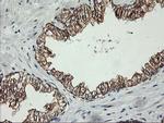 PDSS2 Antibody in Immunohistochemistry (Paraffin) (IHC (P))