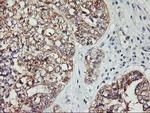 PDSS2 Antibody in Immunohistochemistry (Paraffin) (IHC (P))