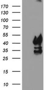 PDSS2 Antibody in Western Blot (WB)