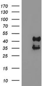 PDSS2 Antibody in Western Blot (WB)