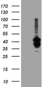 PDSS2 Antibody in Western Blot (WB)