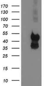 PDSS2 Antibody in Western Blot (WB)