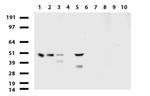 PDSS2 Antibody in Western Blot (WB)