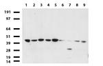 PDSS2 Antibody in Western Blot (WB)
