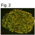 PDX1 Antibody in Immunocytochemistry (ICC/IF)