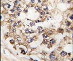 PDX1 Antibody in Immunohistochemistry (IHC)