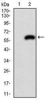 PDX1 Monoclonal Antibody (5A5)