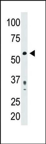 PDX1 Antibody in Western Blot (WB)