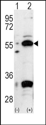 PDX1 Antibody in Western Blot (WB)
