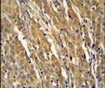 PDXDC1 Antibody in Immunohistochemistry (IHC)