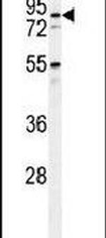 PDXDC1 Antibody in Western Blot (WB)