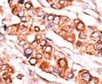 PDXK Antibody in Immunohistochemistry (IHC)