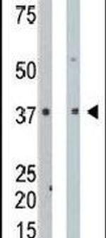 PDXK Antibody in Western Blot (WB)