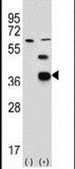 PDXK Antibody in Western Blot (WB)