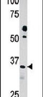 PDXK Antibody in Western Blot (WB)