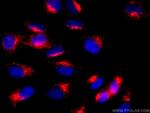 CD107b/LAMP2 Antibody in Immunocytochemistry (ICC/IF)
