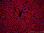 ASGR1 Antibody in Immunohistochemistry (Paraffin) (IHC (P))