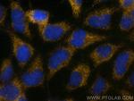 TGF Beta 1 Antibody in Immunocytochemistry (ICC/IF)
