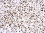 ETV4 Antibody in Immunohistochemistry (IHC)