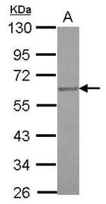 ETV4 Antibody in Western Blot (WB)