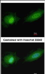 ETV4 Antibody in Immunocytochemistry (ICC/IF)