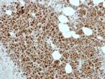 ETV4 Antibody in Immunohistochemistry (IHC)