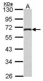 ETV4 Antibody in Western Blot (WB)