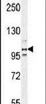 PEAR1 Antibody in Western Blot (WB)