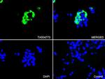 PECAM1 Antibody in Immunocytochemistry (ICC/IF)