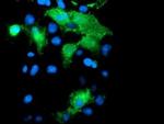 PECAM1 Antibody in Immunocytochemistry (ICC/IF)