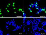 PECAM1 Antibody in Immunocytochemistry (ICC/IF)