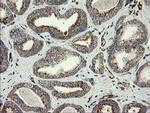 PECAM1 Antibody in Immunohistochemistry (Paraffin) (IHC (P))