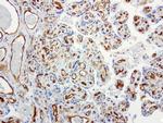 PECAM1 Antibody in Immunohistochemistry (Paraffin) (IHC (P))