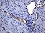 PECAM1 Antibody in Immunohistochemistry (Paraffin) (IHC (P))