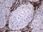 PECAM1 Antibody in Immunohistochemistry (Paraffin) (IHC (P))
