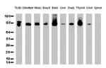 PECAM1 Antibody in Western Blot (WB)