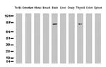 PECAM1 Antibody in Western Blot (WB)