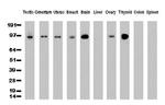 PECAM1 Antibody in Western Blot (WB)