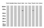 PECAM1 Antibody in Western Blot (WB)