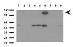 PECAM1 Antibody in Western Blot (WB)